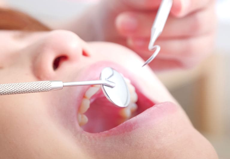 予防歯科について