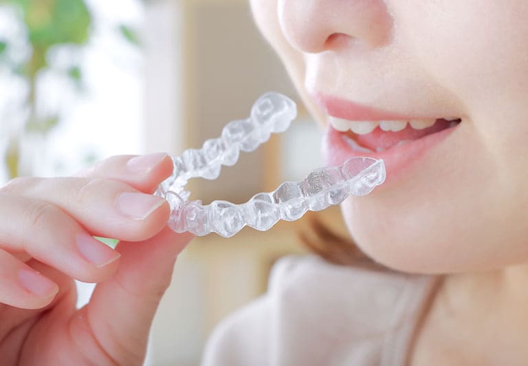 マウスピース矯正とは